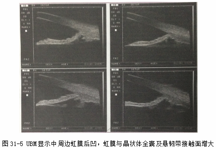 ZY016_158_6.gif
